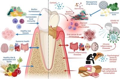 Periodontal Disease: The Good, The Bad, and The Unknown